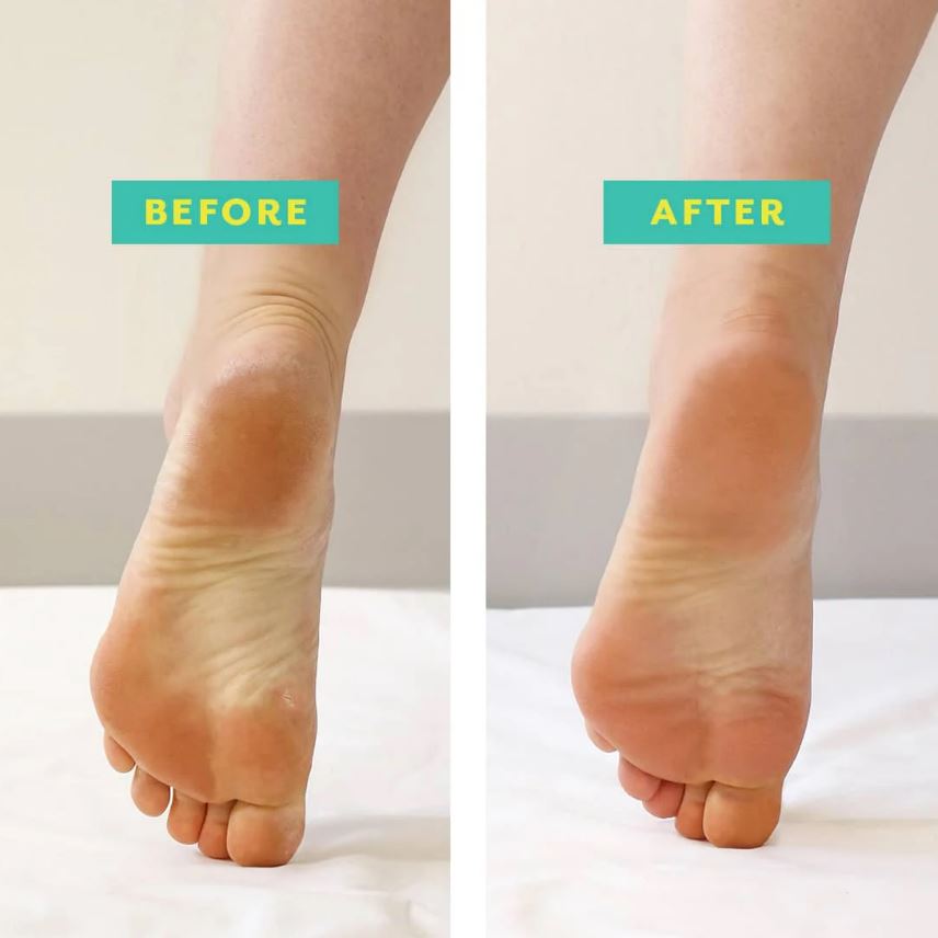 Patchology "Posh Peel" Pedicure